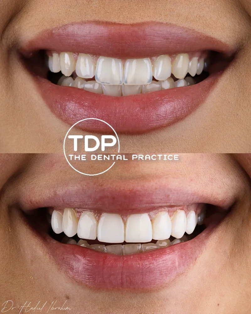 A patient before and after cosmetic treatment at The Dental Practice