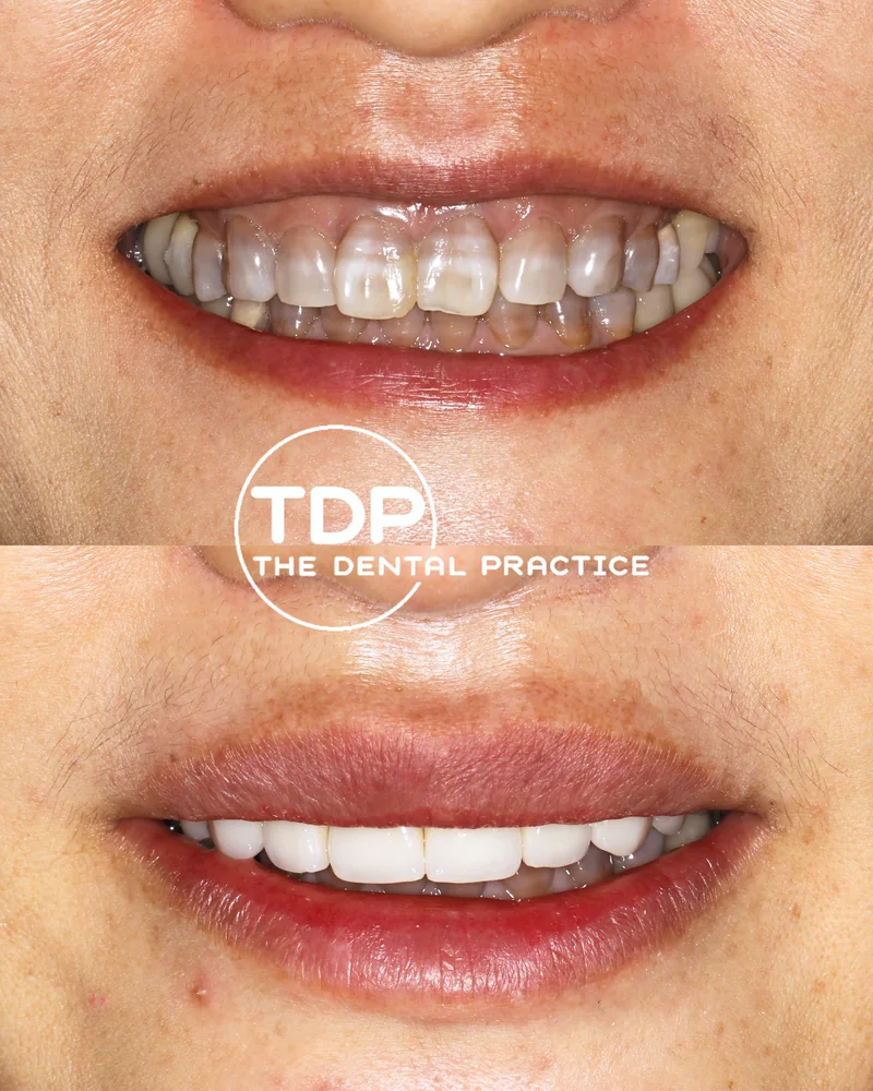 A patient before and after cosmetic treatment at The Dental Practice