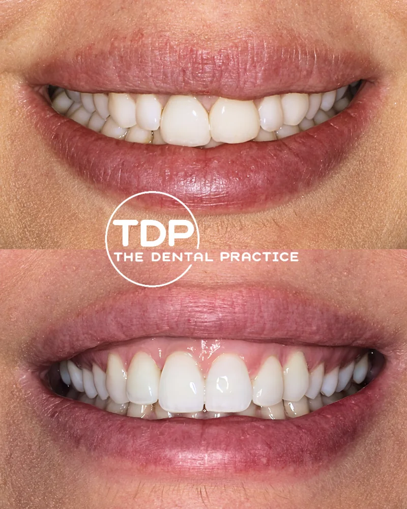A patient before and after cosmetic treatment at The Dental Practice